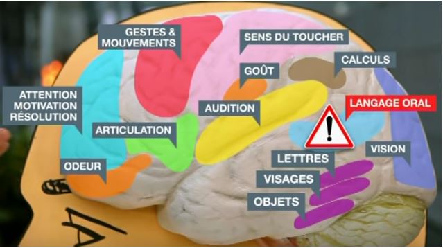 Reconnaître les troubles DYS